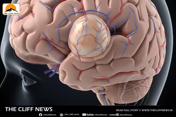 World Brain Tumour Day 2025: Experts Urge Awareness of Early Signs and Dispel Common Myths